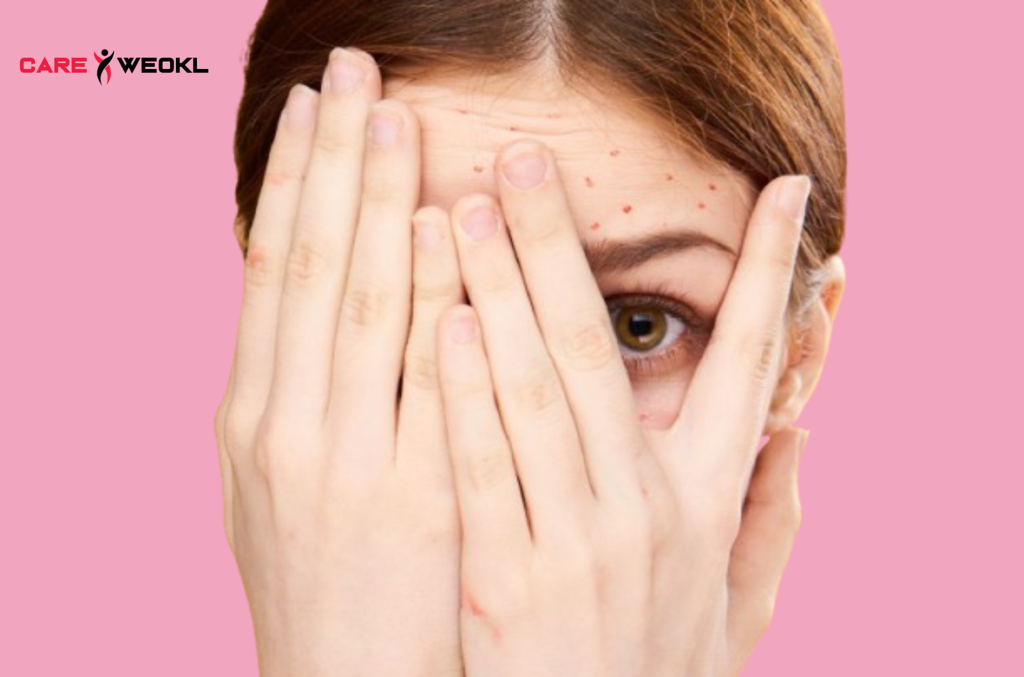 What do these red dots on your skin mean?