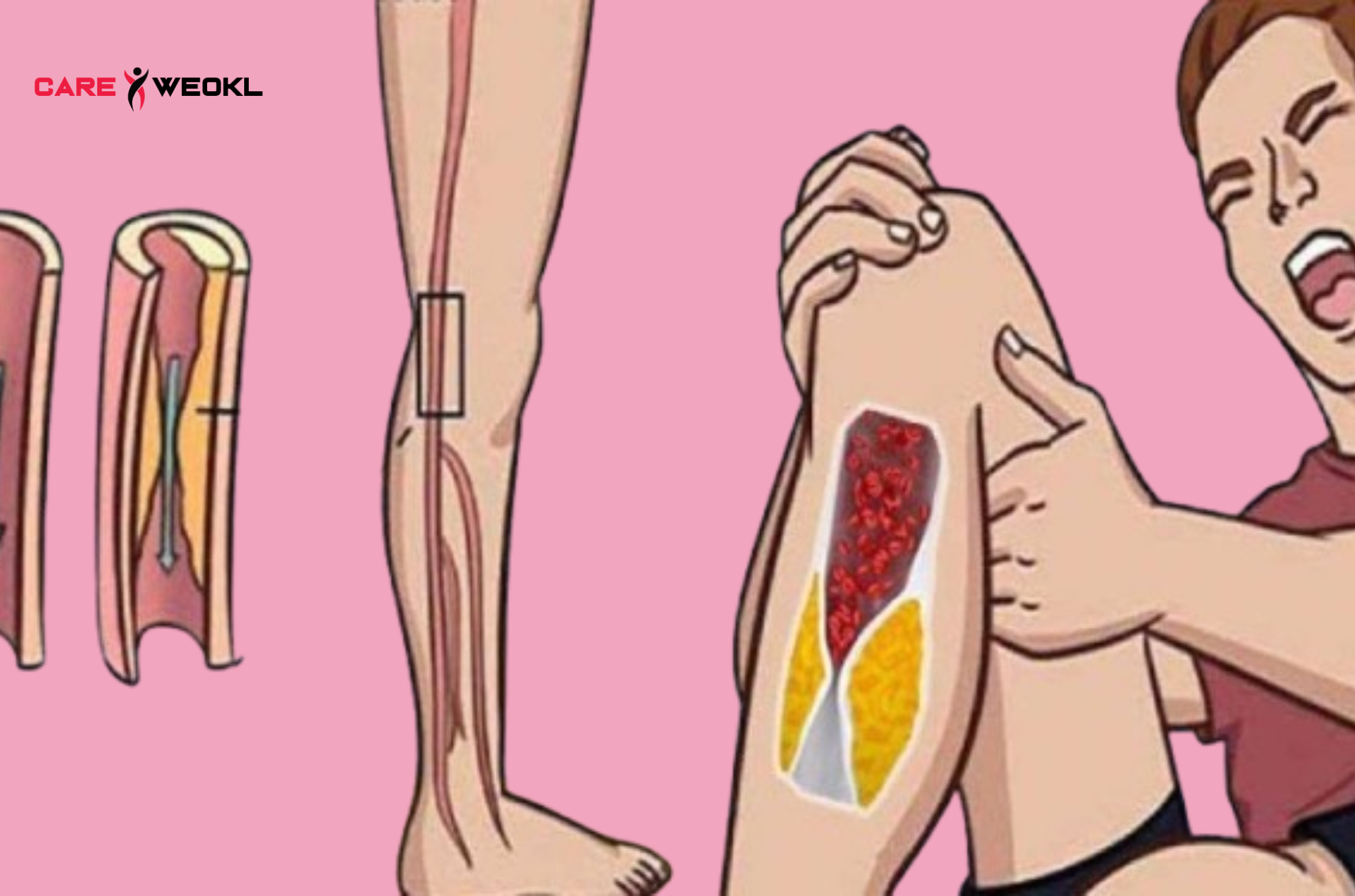 Here Are 7 Warning Signs You Have Blocked Arteries