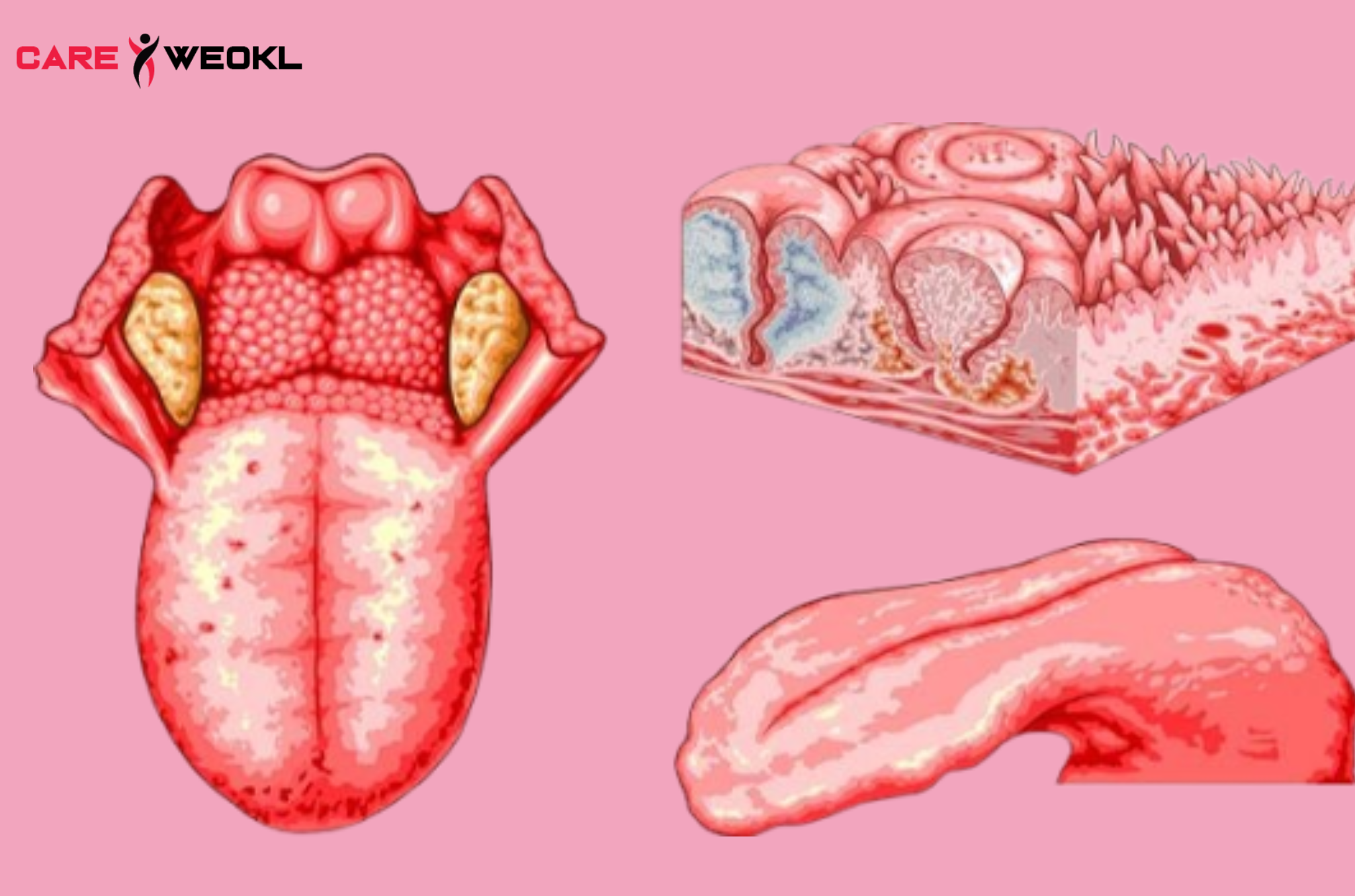 What Your Tongue Says About Your Health
